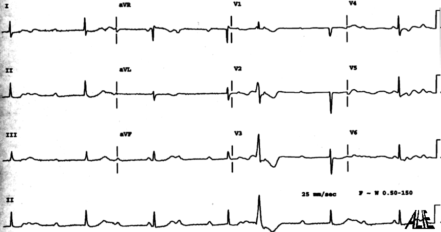 046A.gif (55247 octets)